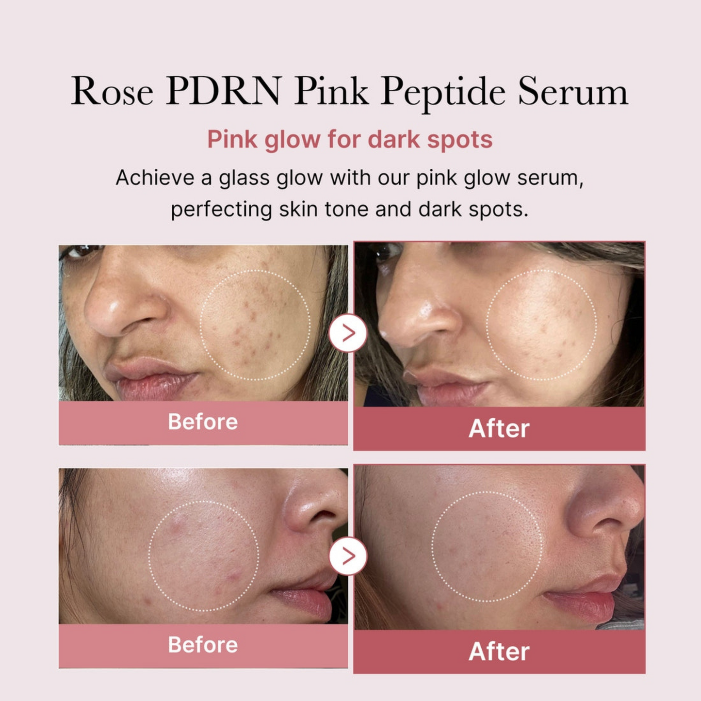 TLOPA® PDRN Pink Peptide Serum