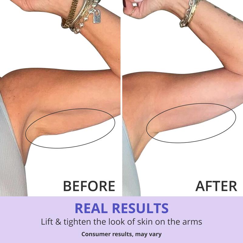 🔥TLOPA® Sculpt & Tone Arm Cream | 7% ProTight + Ashwagandha Root | Firm & Hydrate, Rescue Loose Skin